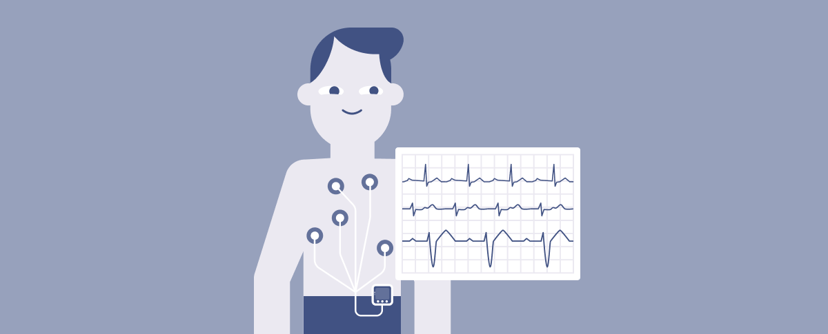 Холтеровское мониторирование | Купрум