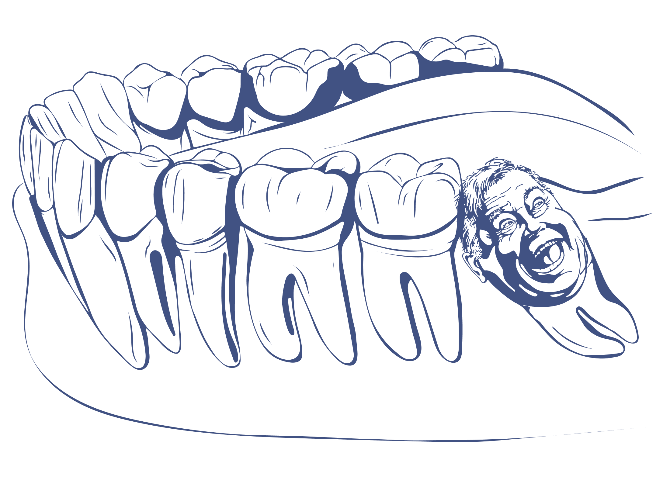 Скажи зуб. Стираемость эмали зубов. Вертикальное стирание зубов.